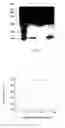 Fig. 04 - Hemoglobin conjugate and the preparation method and its use