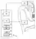 Fig. 01 - Implantable hearing aid actuator positioning