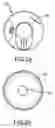Fig. 03 - Implantable hearing aid actuator positioning