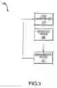 Fig. 04 - Implantable hearing aid actuator positioning