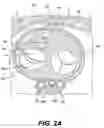 Fig. 03 - Devices and methods for heart valve treatment