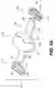 Fig. 08 - Devices and methods for heart valve treatment