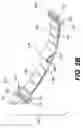 Fig. 09 - Devices and methods for heart valve treatment
