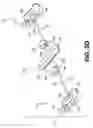 Fig. 11 - Devices and methods for heart valve treatment