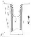 Fig. 25 - Devices and methods for heart valve treatment