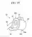 Fig. 18 - Instrument for endoscope