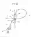 Fig. 22 - Instrument for endoscope