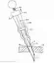 Fig. 01 - Apparatus for inserting a surgical device at least partially through a wound opening