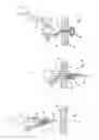 Fig. 03 - Apparatus for inserting a surgical device at least partially through a wound opening