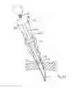 Fig. 20 - Apparatus for inserting a surgical device at least partially through a wound opening