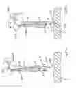 Fig. 23 - Apparatus for inserting a surgical device at least partially through a wound opening