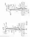 Fig. 24 - Apparatus for inserting a surgical device at least partially through a wound opening