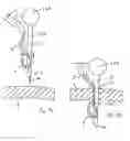 Fig. 59 - Apparatus for inserting a surgical device at least partially through a wound opening