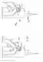Fig. 66 - Apparatus for inserting a surgical device at least partially through a wound opening