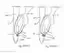 Fig. 67 - Apparatus for inserting a surgical device at least partially through a wound opening
