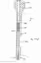 Fig. 76 - Apparatus for inserting a surgical device at least partially through a wound opening