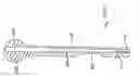 Fig. 78 - Apparatus for inserting a surgical device at least partially through a wound opening