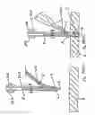 Fig. 80 - Apparatus for inserting a surgical device at least partially through a wound opening