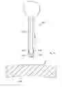 Fig. 83 - Apparatus for inserting a surgical device at least partially through a wound opening