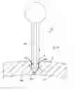 Fig. 84 - Apparatus for inserting a surgical device at least partially through a wound opening