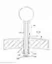 Fig. 85 - Apparatus for inserting a surgical device at least partially through a wound opening