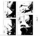 Fig. 06 - System and methods of using image-guidance for providing an access to a cochlear of a living subject