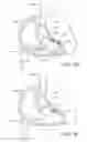 Fig. 07 - Magnetic navigation systems with dynamic mechanically manipulatable catheters