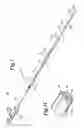 Fig. 02 - Guide wire insertion and re-insertion tools and methods of use