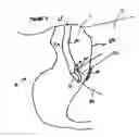 Fig. 06 - Echogenic markers on GI medical devices