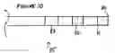 Fig. 10 - Echogenic markers on GI medical devices