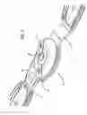 Fig. 05 - Adjustable ergonomic brace