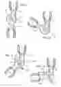 Fig. 08 - Adjustable ergonomic brace