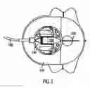 Fig. 02 - Introducer for a medication infusion set