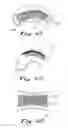 Fig. 09 - BALLOON CANNULAE