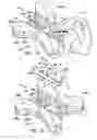 Fig. 07 - Flexible IV site protector