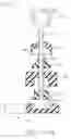 Fig. 06 - Intra-abdominal storage device