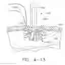 Fig. 41 - Intra-abdominal storage device