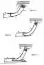 Fig. 24 - Treating back pain by re-establishing the exchange of nutrient and waste