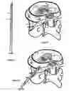 Fig. 30 - Treating back pain by re-establishing the exchange of nutrient and waste