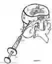 Fig. 34 - Treating back pain by re-establishing the exchange of nutrient and waste
