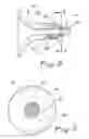 Fig. 06 - URETERAL ACCESS SHEATH