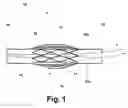 Fig. 02 - System and method for restenosis mitigation