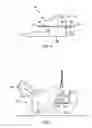 Fig. 04 - Lavage chair and method of use