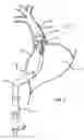 Fig. 04 - Electrical Block Positioning Devices And Methods Of Use therefor