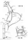 Fig. 05 - Electrical Block Positioning Devices And Methods Of Use therefor