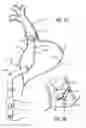 Fig. 06 - Electrical Block Positioning Devices And Methods Of Use therefor