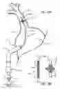 Fig. 11 - Electrical Block Positioning Devices And Methods Of Use therefor