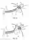 Fig. 13 - Electrical Block Positioning Devices And Methods Of Use therefor