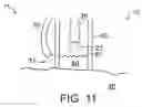 Fig. 08 - Method of treatment body tissue using a non-uniform laser beam