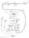 Fig. 03 - Energy delivery devices and methods